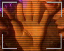 Athlete's Hand Athlete's Hand